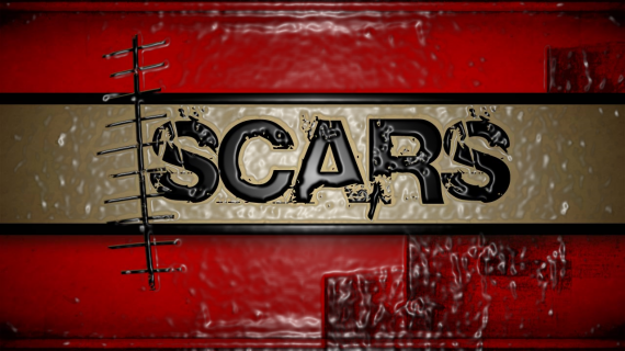 Scars